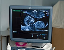 Image of a computer screen showing an ultrasound scan.